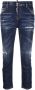 DSQUARED2 Cropped jeans Blauw - Thumbnail 1