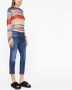 DSQUARED2 Cropped jeans Blauw - Thumbnail 3