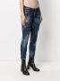 DSQUARED2 Cropped jeans Blauw - Thumbnail 3
