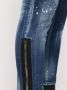 DSQUARED2 Cropped jeans Blauw - Thumbnail 5