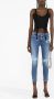 Dsquared2 cropped skinny jeans Blauw - Thumbnail 2