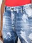 DSQUARED2 Denim shorts Blauw - Thumbnail 5