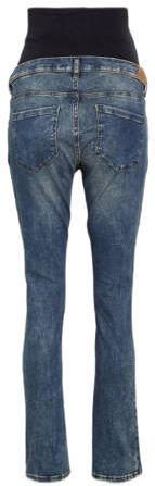 ESPRIT Maternity mom zwangerschapsjeans dark denim Blauw Dames Stretchdenim 34 30