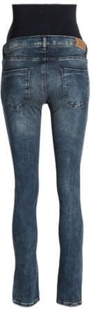 ESPRIT Maternity slim fit zwangerschapsjeans dark denim Blauw Dames Stretchdenim 34 30 - Foto 2