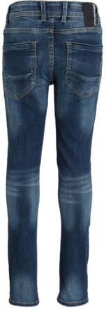 VINGINO skinny jeans Anzio Basic mid blue wash Blauw Jongens Stretchdenim 152 - Foto 3