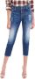 Dsquared2 Stijlvolle Cropped Jeans Blauw Dames - Thumbnail 1