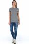 Frankie Morello Vintage Skinny Jeans voor Moderne Mannen Blue Dames - Thumbnail 2