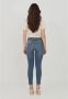 Pinko Jeans Blauw Dames - Thumbnail 2
