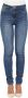 Liu Jo Blauwe Jeans met Gebruikte Wassing en Vernietigde Details Blue Dames - Thumbnail 4