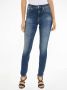 Calvin Klein Jeans Blauwe Dames Jeans met Rits en Knoop Blue Dames - Thumbnail 2
