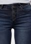 Arizona Skinny fit jeans Ultra Stretch Highwaist met doorknoopsluiting - Thumbnail 3