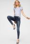 Arizona Skinny fit jeans Ultra Stretch moon washed - Thumbnail 4