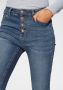 Hailys high waist skinny jeans Romina zwart - Thumbnail 15