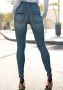 Lascana High-waist jeans met goudkleurige knopen - Thumbnail 3