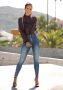 Lascana High-waist jeans met zichtbare knoopsluiting - Thumbnail 7