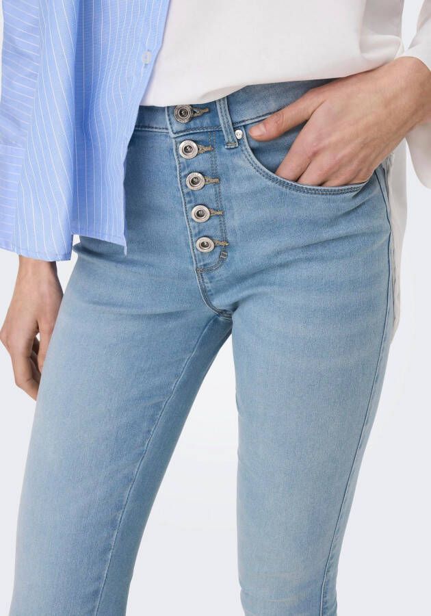 Only High-waist jeans ONLROYAL HW SK FLY BTN GUA DK BLUE BOX