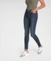 Only Skinny fit jeans ONLPAOLA met stretch - Thumbnail 3