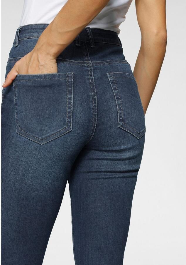 Only Skinny fit jeans ONLPAOLA – Extra strak gesneden jeans met figuurvormend silhouet - Foto 4