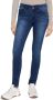 Tom Tailor Skinny fit jeans Alexa Skinny met een dubbele knoopsluiting - Thumbnail 2