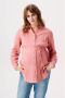Noppies zwangerschaps- en voedingsblouse Arles roze Dames Katoen Opstaande kraag XXL - Thumbnail 1