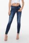 Only Blauwe versleten dames jeans met ritssluiting en knoopsluiting Blue Dames - Thumbnail 1