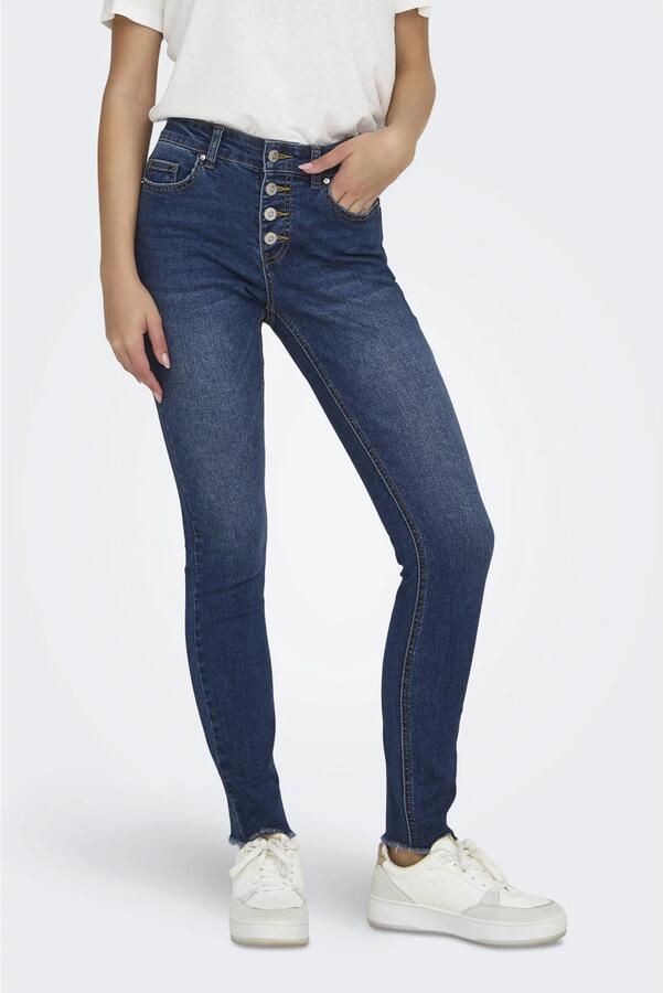 Only Skinny fit jeans ONLMIA MID WAIST BUTTON SK RW ANK BOX - Foto 2