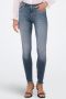 Only Ankle jeans ONLBLUSH MID SK ANK RAW DNM - Thumbnail 1