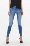 Only Skinny fit jeans ONLBLUSH MID SKINNY ANKLE ZIP DNM BOX - Thumbnail 1