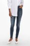 Only Blauwe effen jeans met ritssluiting en knoopsluiting Blue Dames - Thumbnail 1